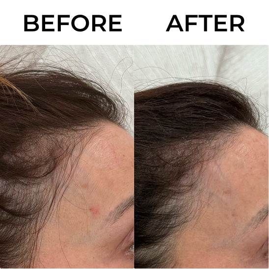 Beauty Peptides