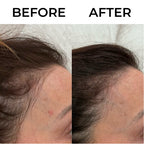Beauty Peptides